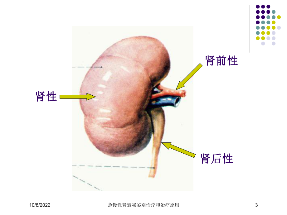 急慢性肾衰竭鉴别诊疗和治疗原则培训课件.ppt_第3页