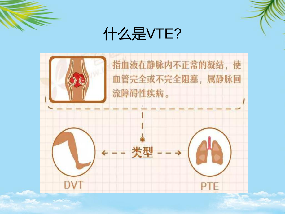 教培用血栓的预防与管理课件.pptx_第2页