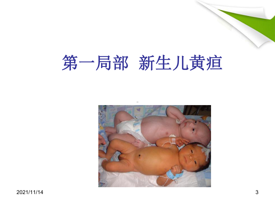 新生儿黄疸颅内出血课件.ppt_第3页