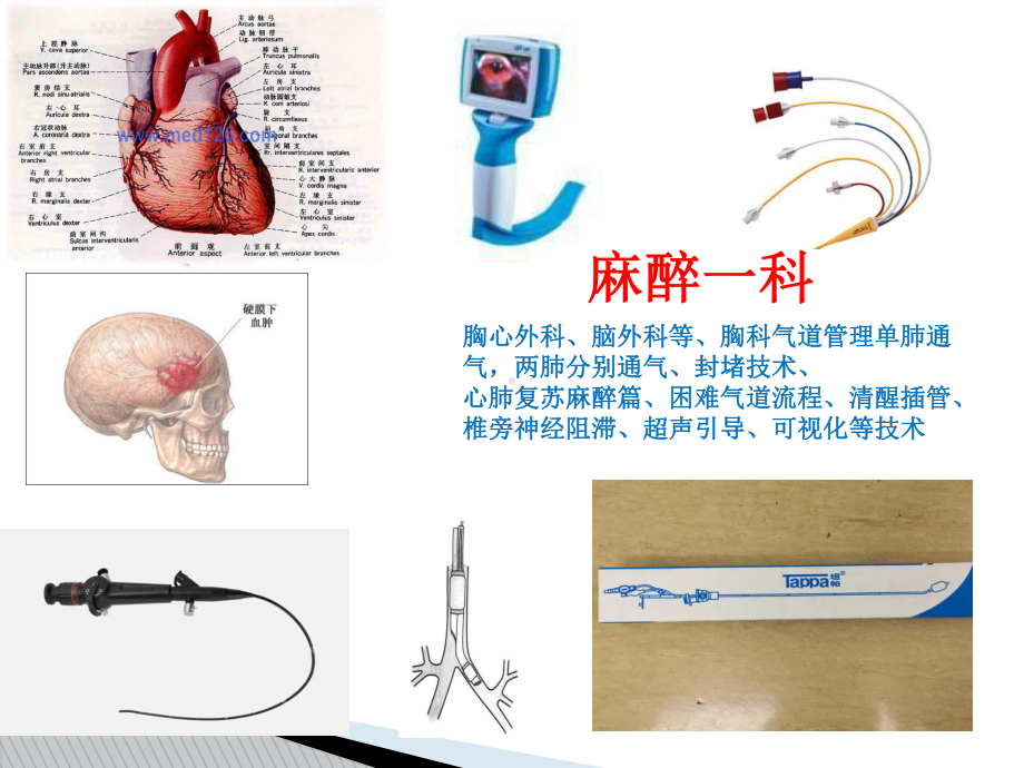 支气管封堵器插入与定位左肺封堵裴焕爽课件.ppt_第2页