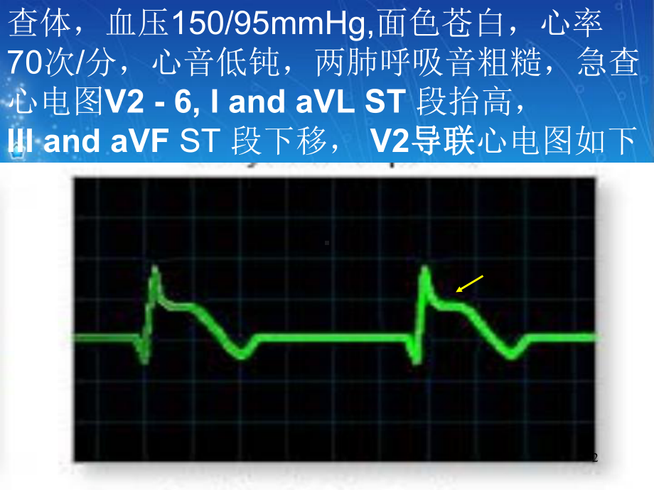 心血管病例讨论学习课件.ppt_第2页