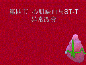 心肌缺血与心梗-课件.ppt