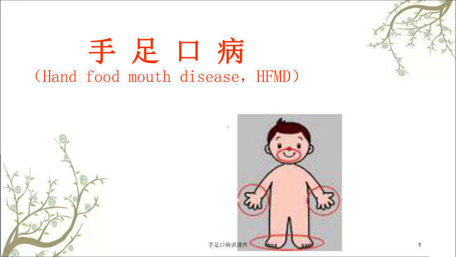 手足口病讲课件.ppt_第1页