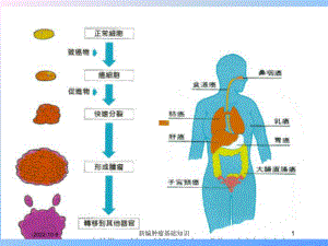 新编肿瘤基础知识培训课件.ppt