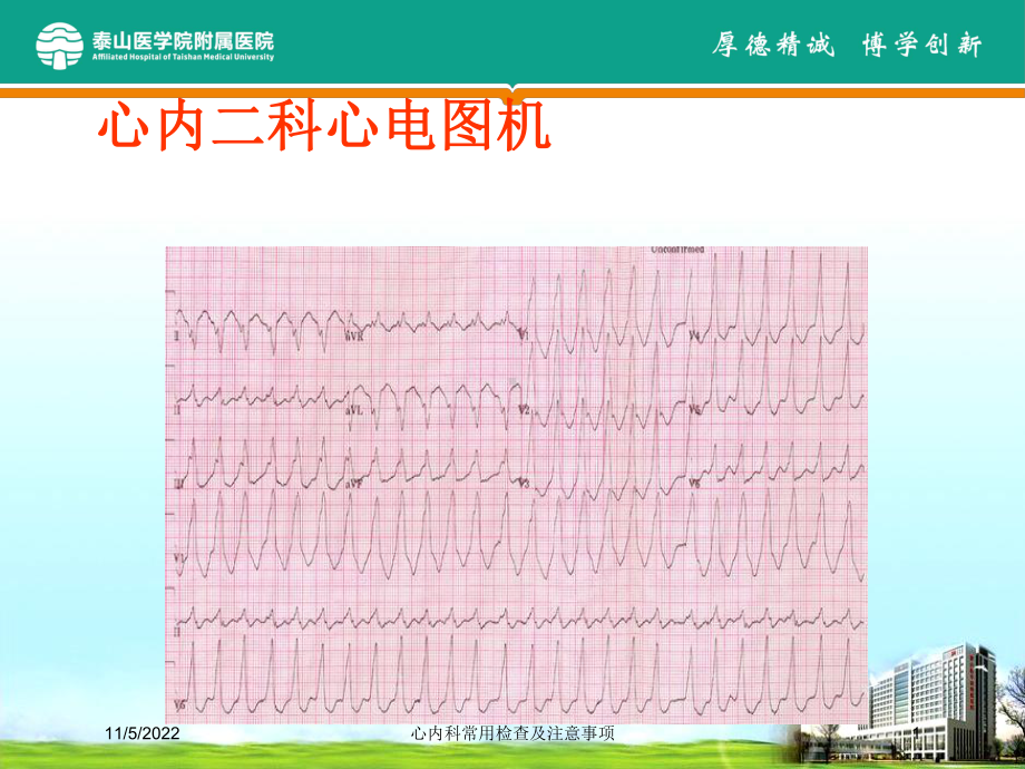 心内科常用检查及注意事项培训课件.ppt_第1页