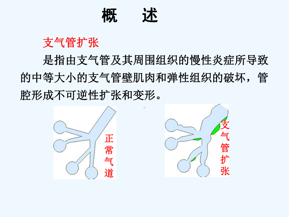 支气管扩张病人护理汇总课件.ppt_第3页