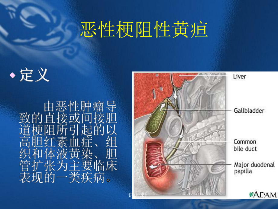 恶性梗阻性黄疸(行业特制)课件.ppt_第2页