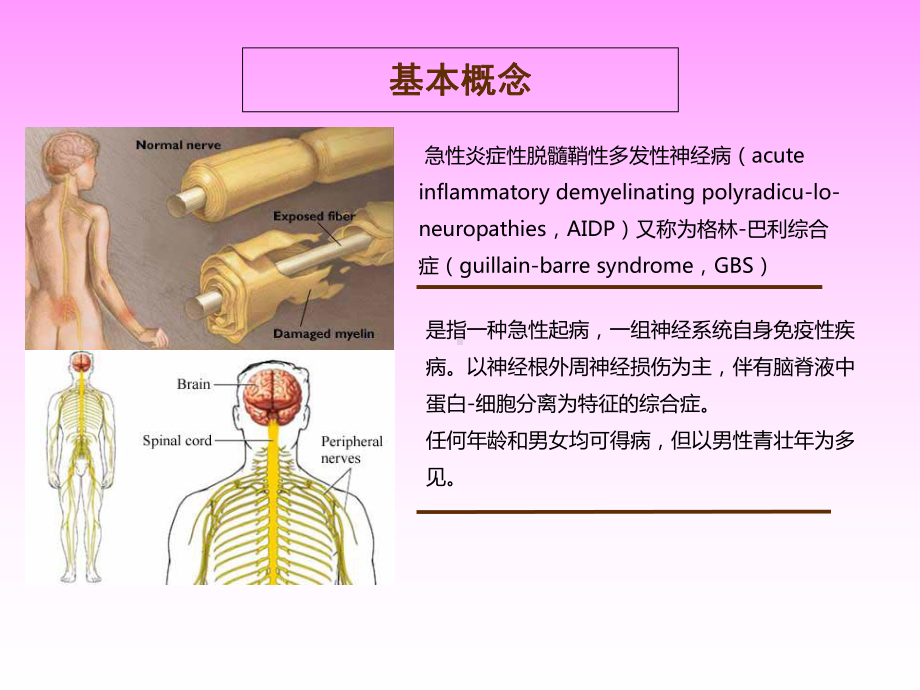 格林巴利综合症护理查房—课件.ppt_第3页