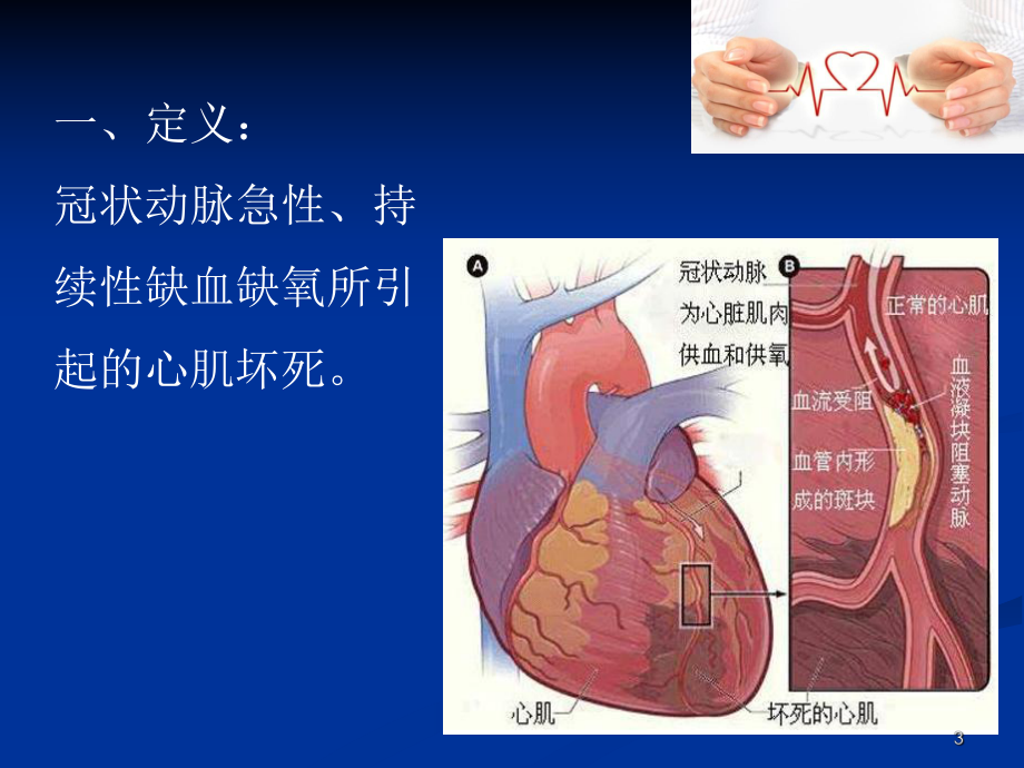 急性心梗抢救流程释解课件.pptx_第3页