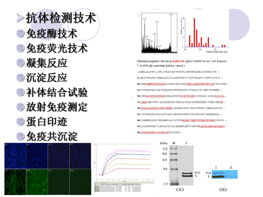 抗体检测技术与类风湿因子课件.ppt_第2页