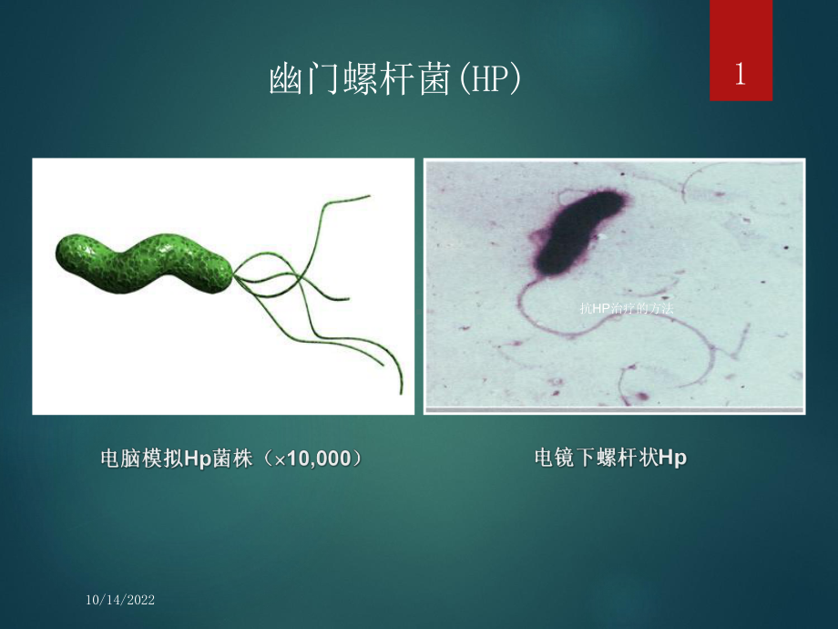 抗HP治疗的方法培训课件.ppt_第1页