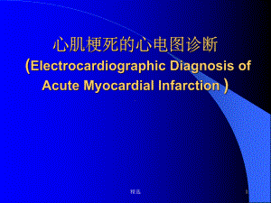 心肌梗死的心电图课件.ppt