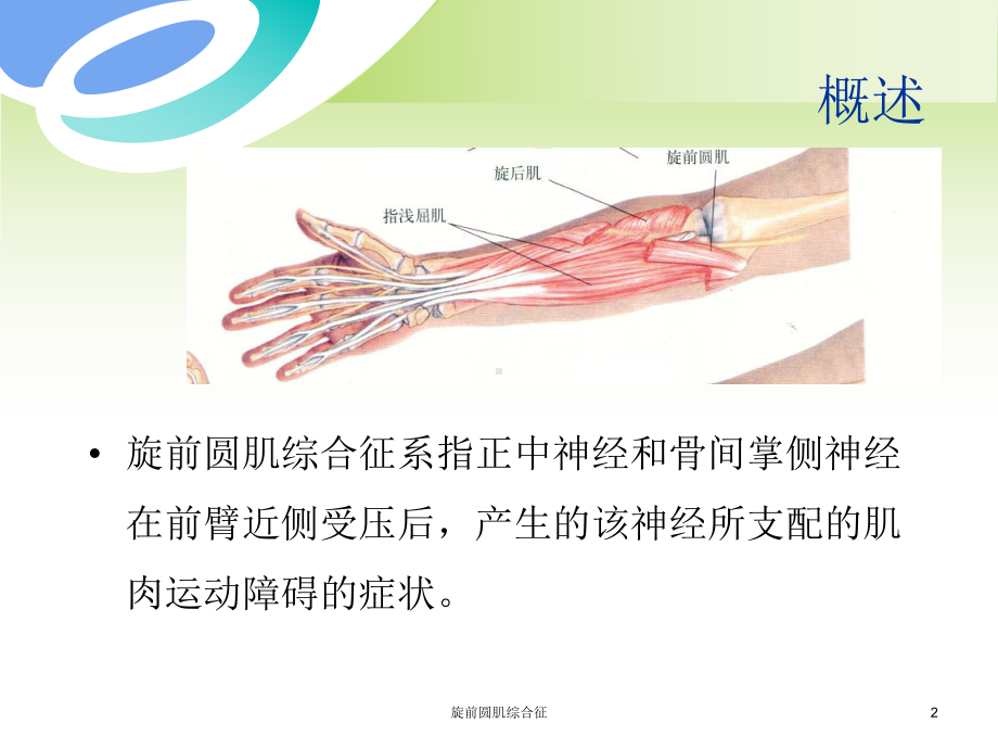 旋前圆肌综合征培训课件.ppt_第2页