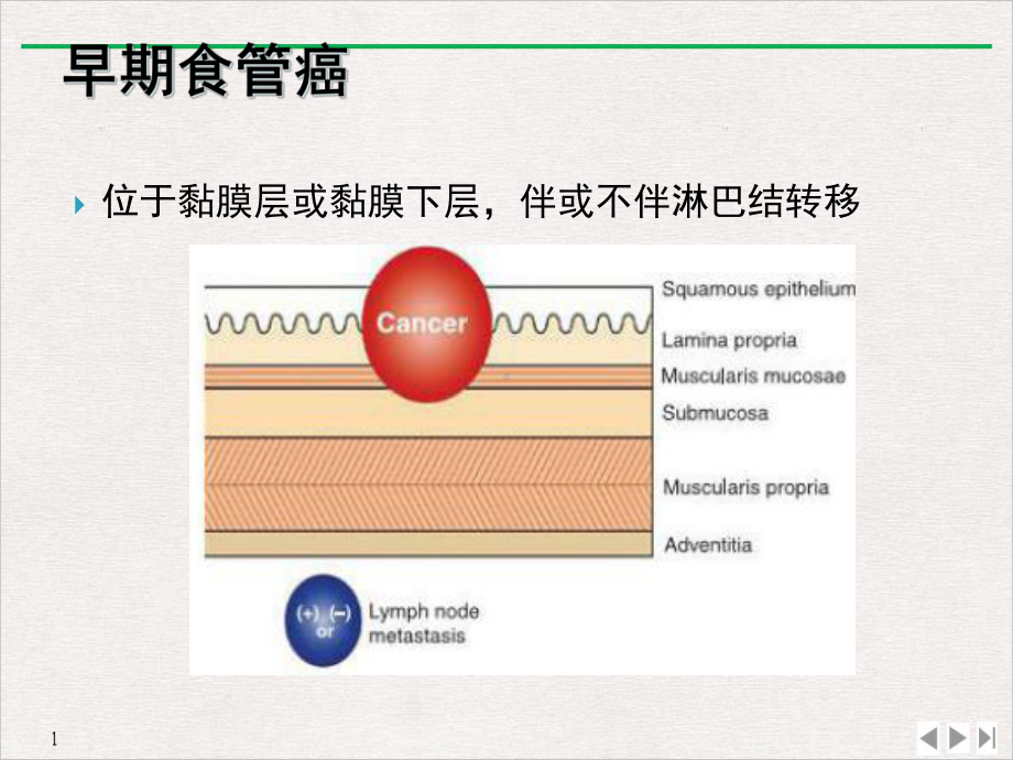 放大在食管早癌诊断中的应用进展课件.ppt_第2页