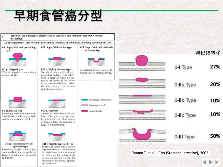 放大在食管早癌诊断中的应用进展课件.ppt_第3页