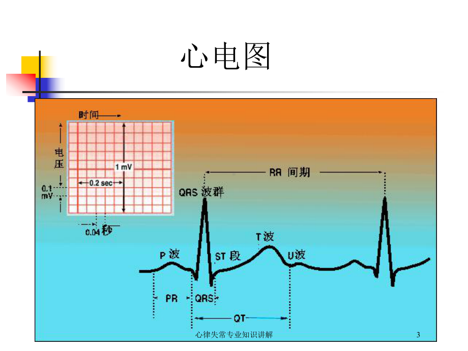 心律失常专业知识讲解培训课件.ppt_第3页