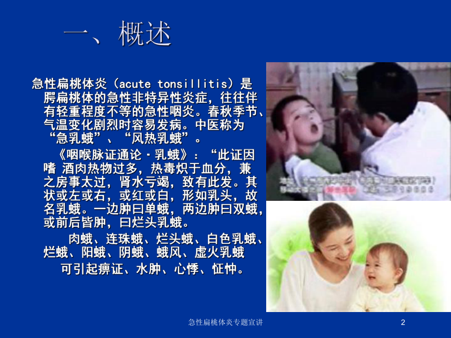 急性扁桃体炎专题宣讲培训课件.ppt_第2页