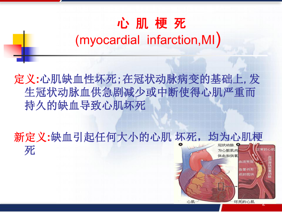 急性心肌梗死的急救与护理-课件.pptx_第2页