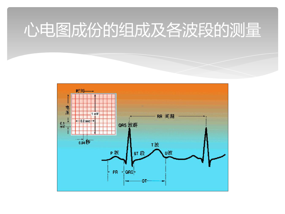 常见心电图及心肌梗死心电图的诊断课件.pptx_第3页