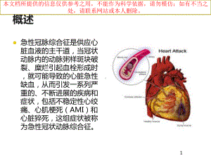 急性冠状动脉综合征急救护理培训课件.ppt