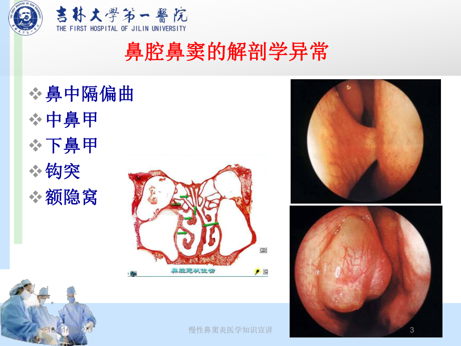 慢性鼻窦炎医学知识宣讲培训课件.ppt_第3页