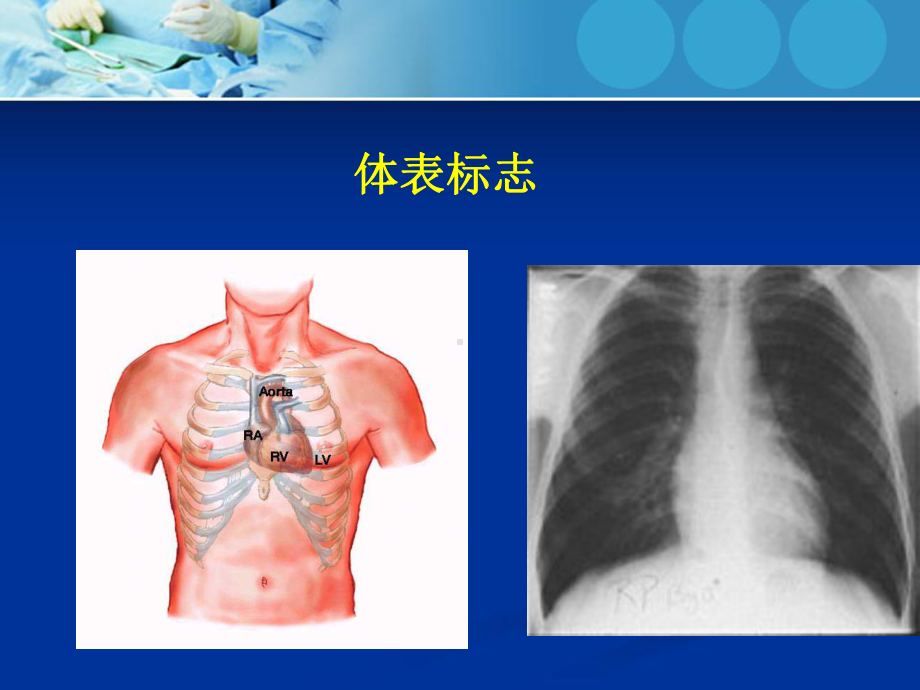 心内科体格检查培训课件.ppt_第3页