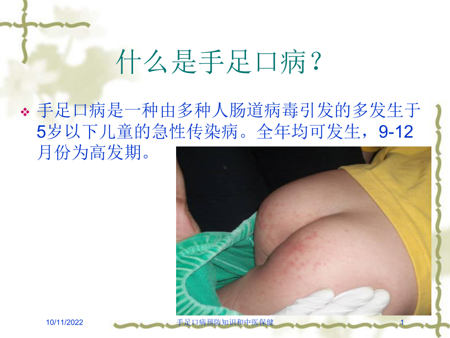 手足口病预防知识和中医保健培训课件.ppt_第1页