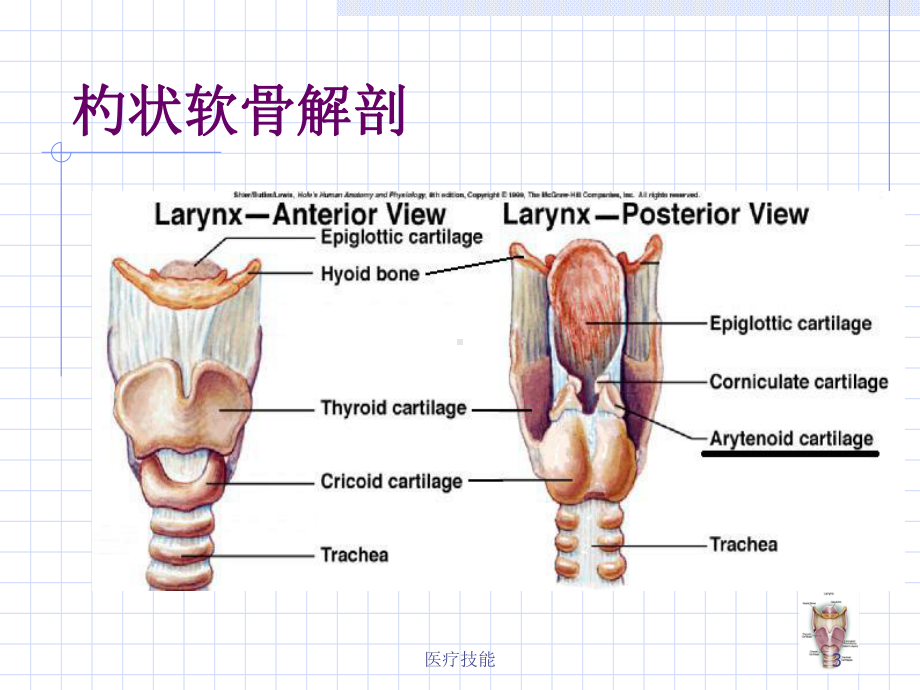 杓状软骨脱位的原因及处理(医学技术)课件.ppt_第3页