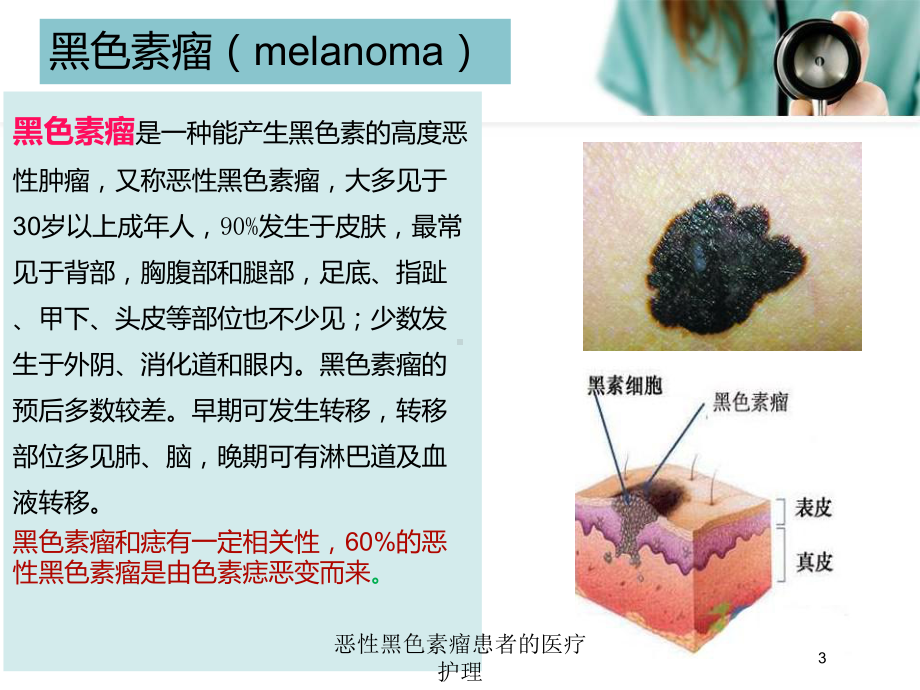 恶性黑色素瘤患者的医疗护理培训课件.ppt_第3页