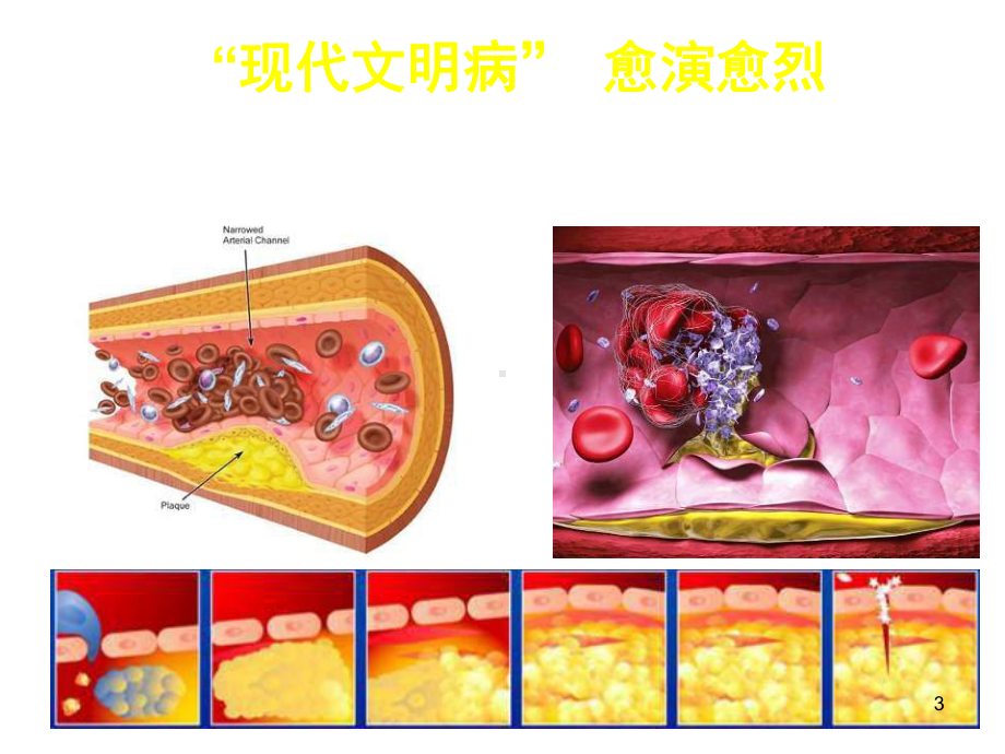 心血管健康讲座参考课件.ppt_第3页