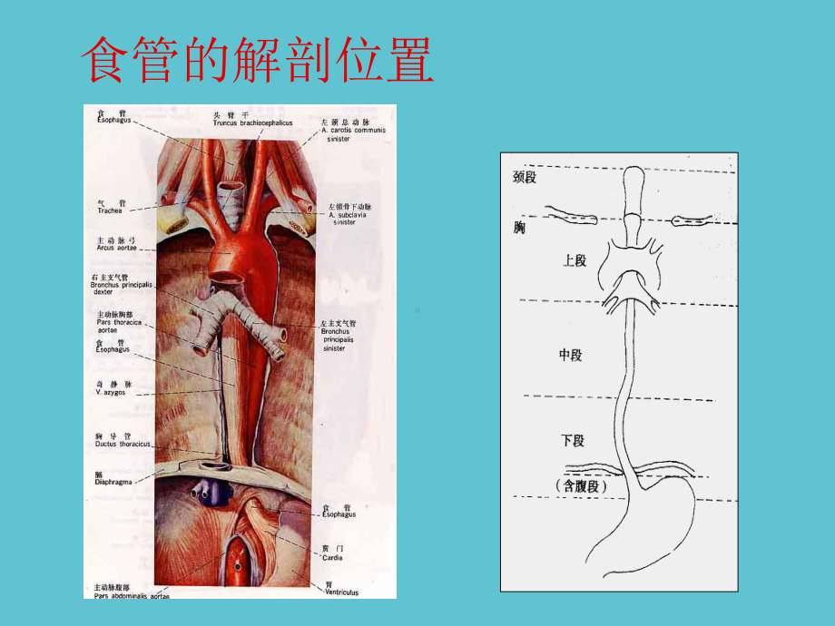 授课用-食管癌的健康教育课件.ppt_第3页