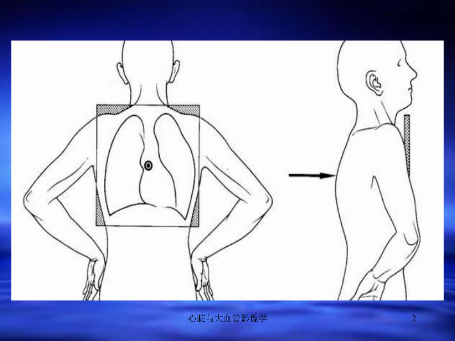 心脏与大血管影像学课件.ppt_第2页