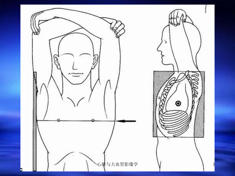 心脏与大血管影像学课件.ppt_第3页