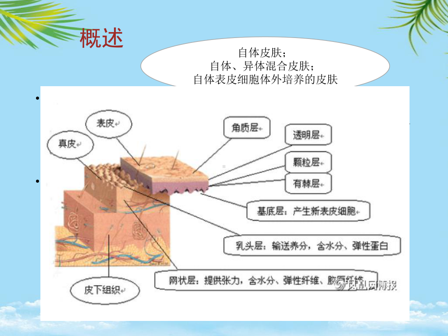 植皮病人的围手术期护理-全面课件.pptx_第3页