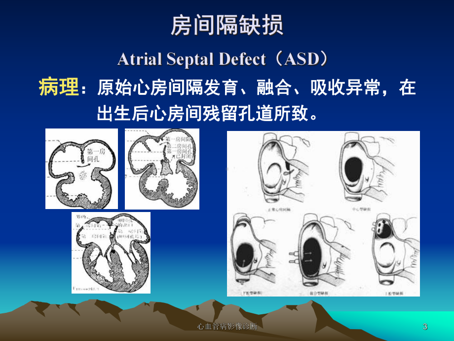 心血管病影像诊断课件.ppt_第3页