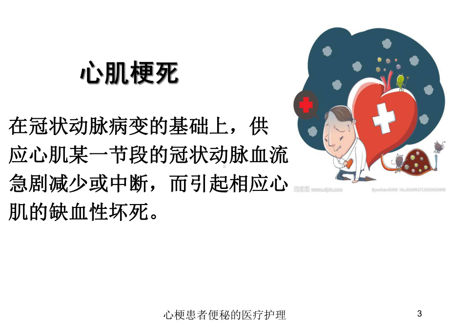 心梗患者便秘的医疗护理培训课件.ppt_第3页