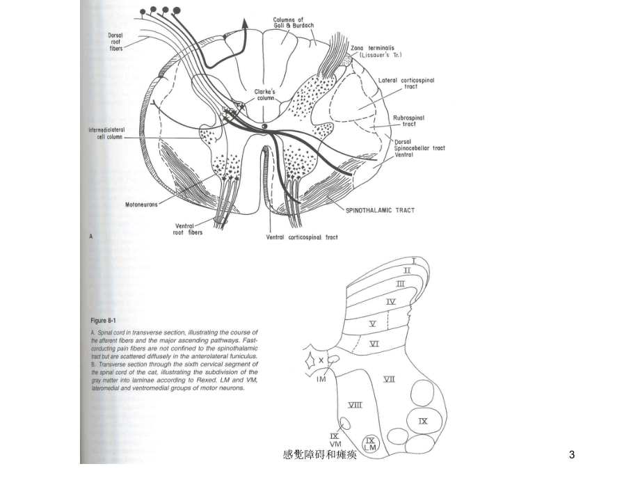 感觉障碍和瘫痪培训课件.ppt_第3页