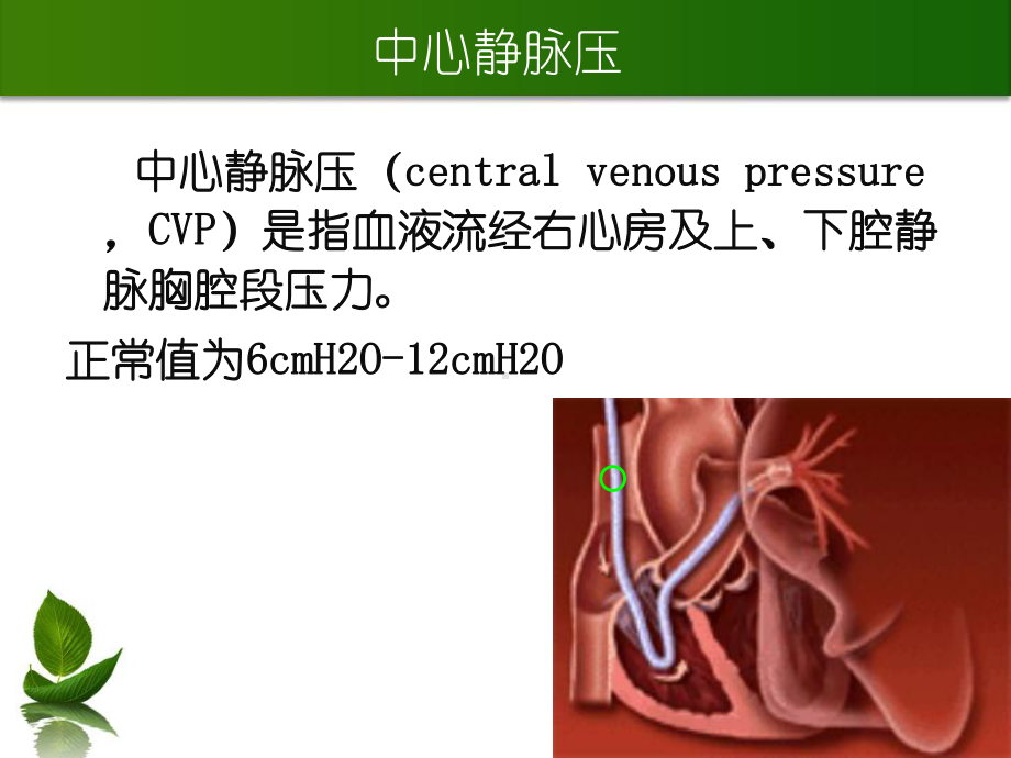 心静脉压测定及中心静脉导管护理课件.ppt_第3页