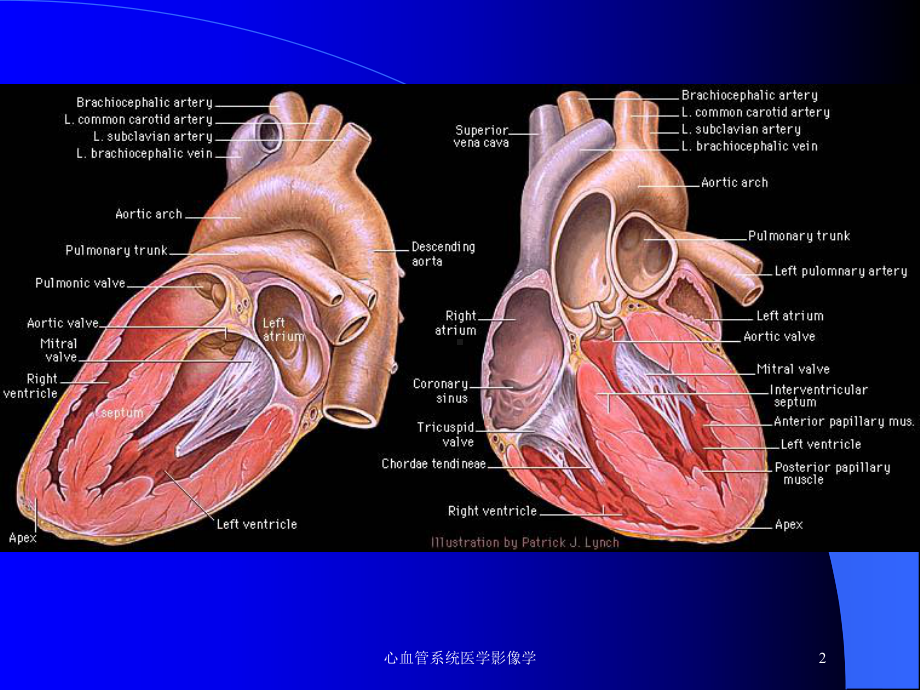 心血管系统医学影像学培训课件.ppt_第2页