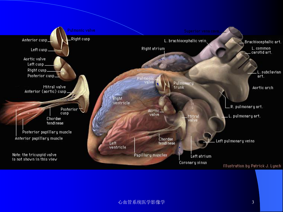 心血管系统医学影像学培训课件.ppt_第3页