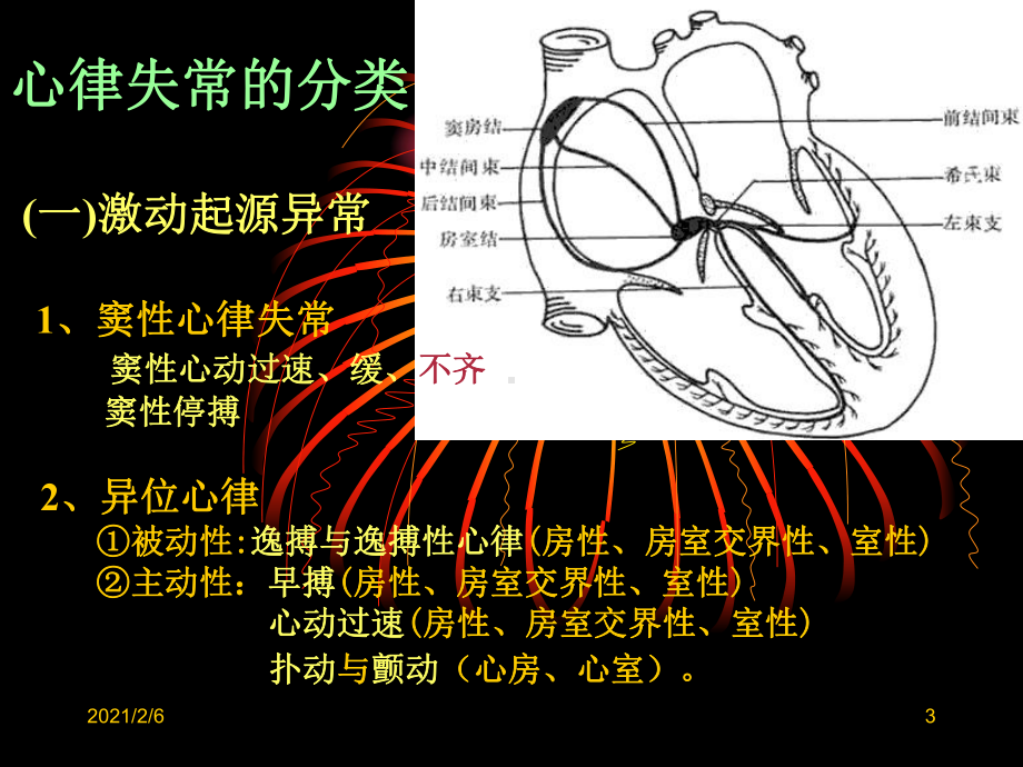 心电图3—心律失常课件.ppt_第3页