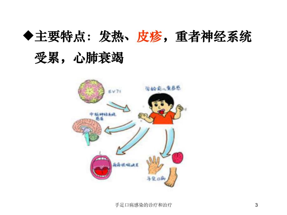 手足口病感染的诊疗和治疗培训课件.ppt_第3页