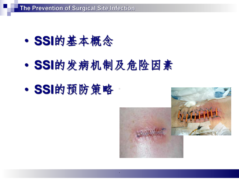 手术部位感染预防与控制新课件-2.ppt_第2页