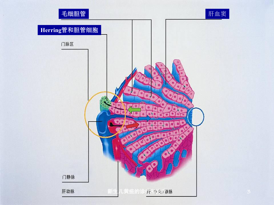 新生儿黄疸的诊疗和治疗培训课件.ppt_第3页