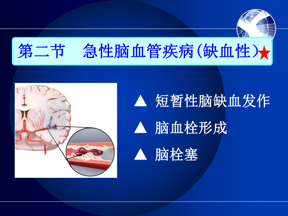 护士执业资格考试内科护理学第九章神经系统疾病病人护课件.ppt_第2页