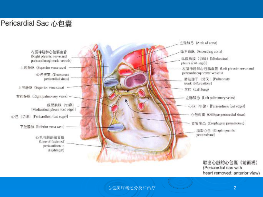 心包疾病概述分类和治疗培训课件.ppt_第2页