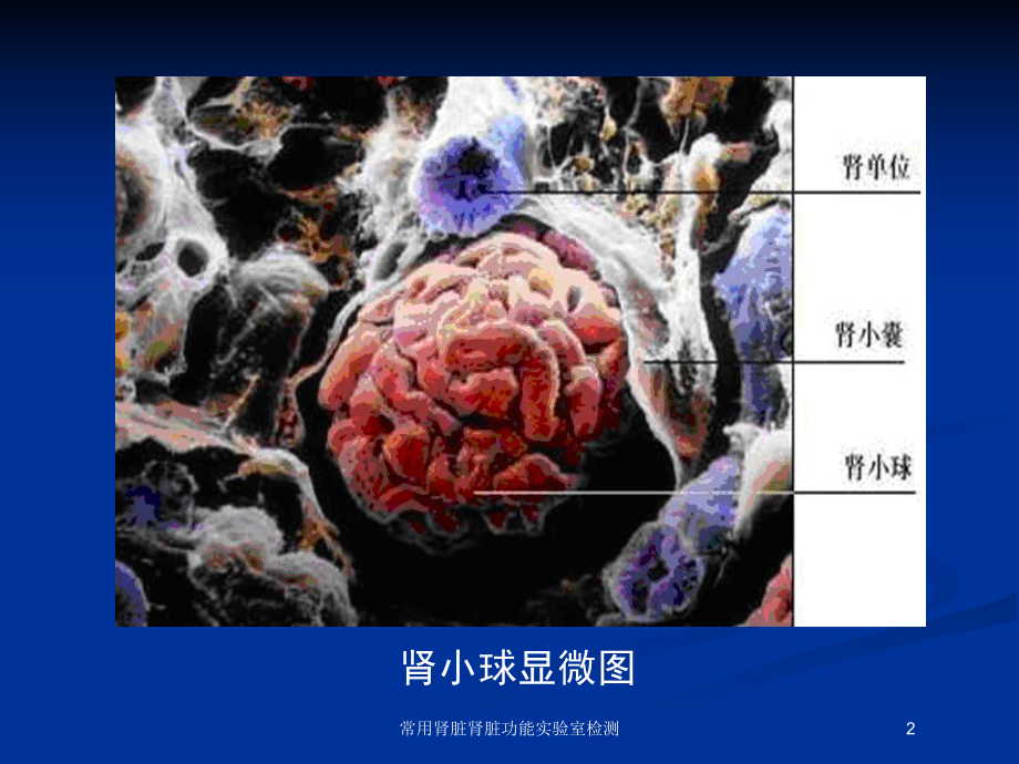 常用肾脏肾脏功能实验室检测培训课件.ppt_第2页