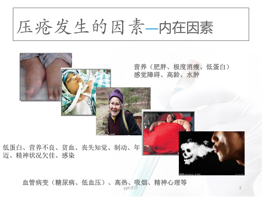 手术室压疮的预防-课件.ppt_第3页