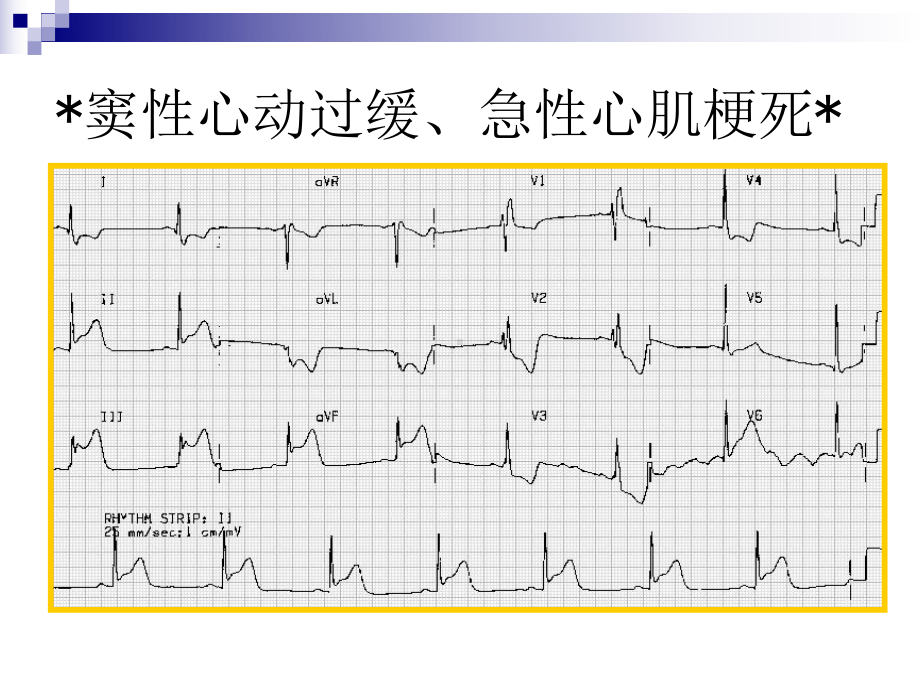 心电图考试题与答案一课件.pptx_第2页