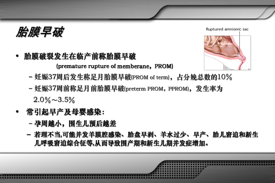 早产胎膜早破课件.ppt_第2页